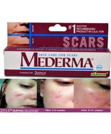 Mederma Ayurvedic Cream for Scars, Surgery, Injury, Burns, Acne & Cut Marks - 10g - Buy Online on GoSupps.com