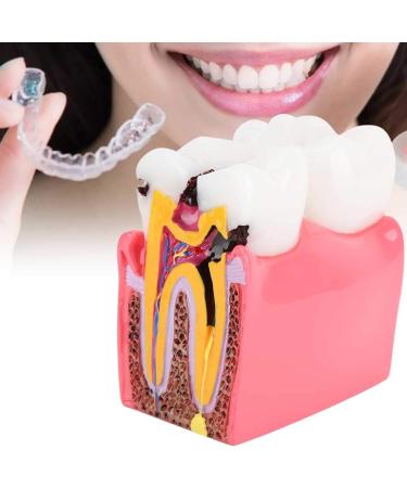 Comprehensive Caries Studies & Oral Hygiene Resources for Dentists - Preventive Care Education - Buy Online on GoSupps.com
