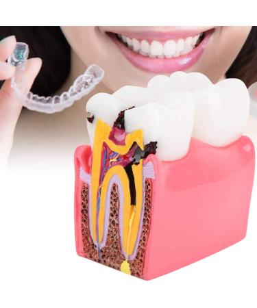 High-Quality Dental Prosthesis Model for Oral Care | International Shipping Available - Buy Online on GoSupps.com
