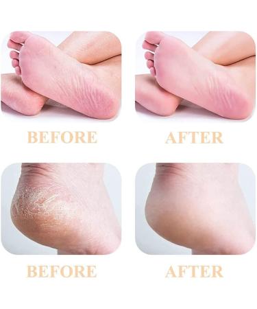 P4L 6 Pack Replacement Heads for Flawless Pedi Electric Foot File - 3 Coarse & 3 Fine Rollers - Grey - Compatible with Finishing Touch Flawless Pedi - As Seen on TV - Buy Online on GoSupps.com