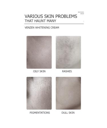 VENZEN Moisturizing Nourishment Cream - Oil Balance Reduce Dullness & Deep Hydration | 30g/1oz - Best for All Skin Types - Buy Online on GoSupps.com