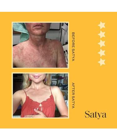 Satya Organic Eczema Balm Stick - 1 oz Full Body Treatment for Adults & Kids - Buy Online on GoSupps.com