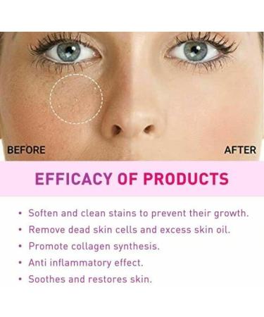ZHBiwmatn 2024 New 4Pcs Milia Clearing Essence Milia Remover Eye Serum Milia Remover Milia Spot Treatment Miliary Repair Essence Moisturize Skin Improve Skin Texture for All Skin Types 30ml/1.8fl.oz - Buy Online on GoSupps.com