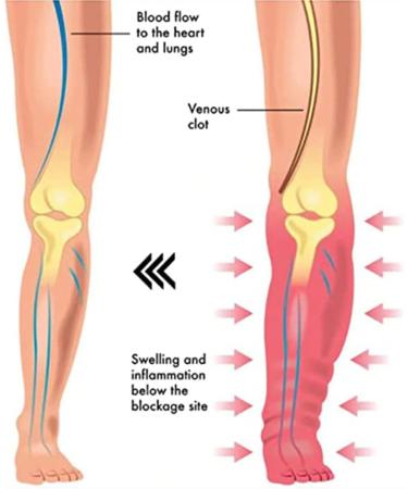 Buy Tumnea Magnetic Hardship Health Bracelet | Lymphatic Drainage & Detox for Weight Loss | Unisex Magnetic Therapy Bracelet - Buy Online on GoSupps.com