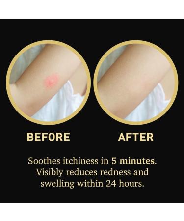 Hypochlorous Acid HOCl Gel Serum for Itchy Irritated Skin from Outdoor Exposure | Cooling Relief | Non-Sting Fragrance-Free | Gentle for Kids & Sensitive | Lightweight Formula for Daily Use | 2oz - Buy Online on GoSupps.com