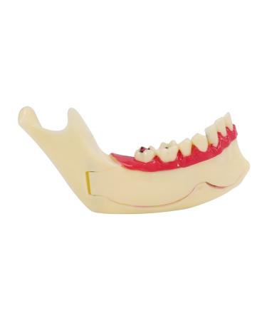 Acfthepiey Dental Treatment Model Anatomy of Gums Dental Study Teaching Teeth Model