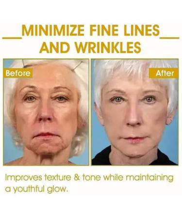 Advanced Firming and Wrinkle Reducing Cream Skin Repair Exfoliator Multi-Purpose Exfoliator(2pcs) - Buy Online on GoSupps.com