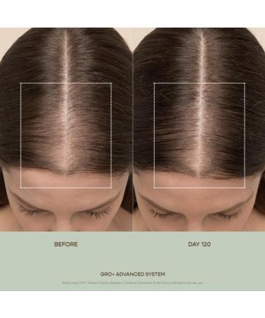VEGAMOUR GRO+ Advanced Hair Serum - Boost Hair Density Reduce Shedding Vegan & Cruelty-Free 30 Day Supply for Thinning Hair - Buy Online on GoSupps.com