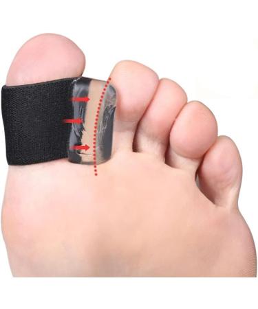 Minkissy Toe Separator Set - 4 Pairs Big Toe Spacers for Bunion Corrector and Hammer Toe Straightener - Hallux Valgus Relief and Thumb Splint Included - Buy Online on GoSupps.com