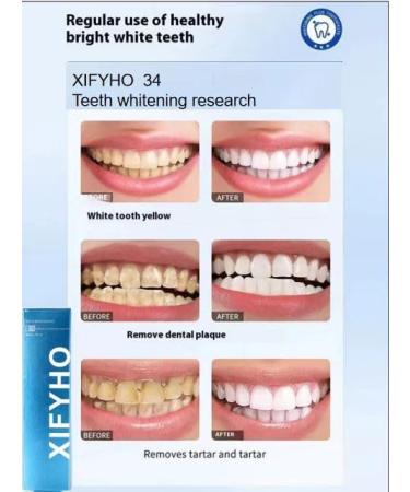 XIFYHO Fresh Mint Toothpaste Set Hundreds of mini Breath-freshening Strips for Hours of Freshness 4-Pack - Buy Online on GoSupps.com