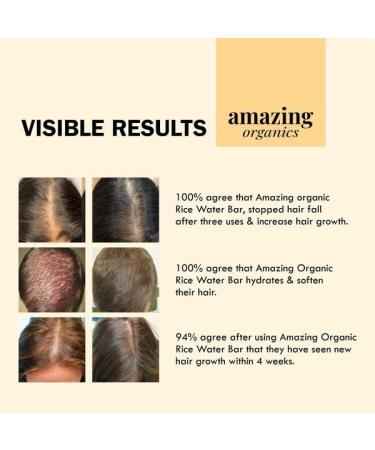 Rice Water Hair Growth Bar - Organic Shampoo Alternative for Nourished Hair | International Shipping - Buy Online on GoSupps.com