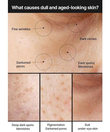 celimax Pore+Dark Spot Brightening Cream | with Niacinamide Tranexamic Acid TXA Cream Pore Minimizer Non-Irritating Hydrating For Sensitive Skin Valentine's Gift 35ml - Buy Online on GoSupps.com