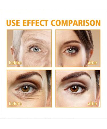 blloocod 5D Peptide Eye Cream for Dark Circles and Puffiness Anti-Aging Eye Moisturizer with Peptides and Hyaluronic Acid Lightweight Eye Cream for Fine Lines (1) - Buy Online on GoSupps.com