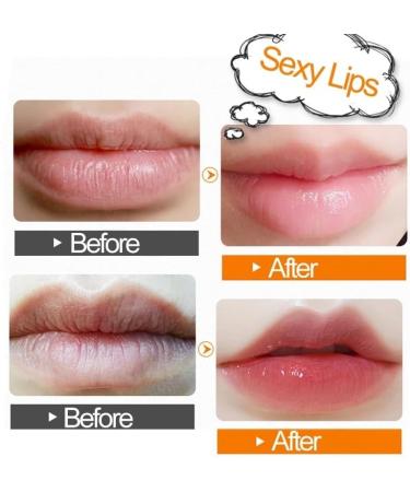 5pc Crystal Collagen Lip Plumper Mask Honey Essence Lip Mask Pads Moisture Anti Aging Wrinkle Patch Gel Scrub Lips (Color : B) - Buy Online on GoSupps.com