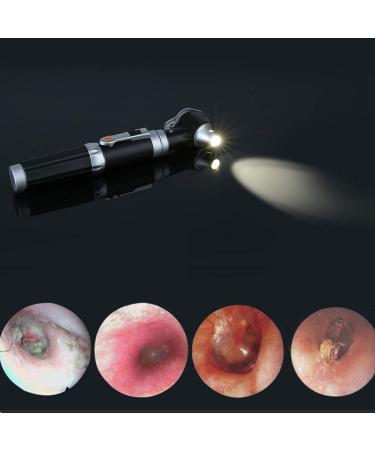 Bysameyee Mini Ear Otoscope | LED Light | Magnification Diagnostic Tool for Ear Health | Ideal for Doctors, Nurses, Adults, Kids, Babies, Elderly, Pets - Buy Online on GoSupps.com
