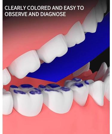Buy Blue Dental Articulation Paper | Thin Tooth Bite Recording for Clinics & Laboratories - Buy Online on GoSupps.com