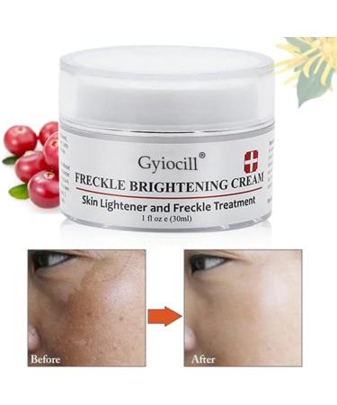  Gyiocill Anti-blemish cream freckle removal cream for face and body skincare product improves skin tone and quality suitable for all skin types - Buy Online on GoSupps.com