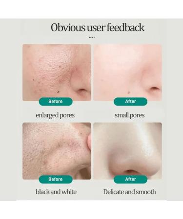 JOIEFIEX Southern Xiehe Facial Cleanser with Niacinamide - 1pc - Buy Online on GoSupps.com