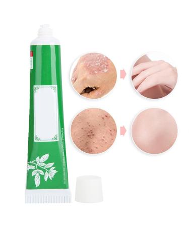 Psoriasis Herbal Body Ointment - Fast Relief for Eczema & Itching - 15g - Buy Online on GoSupps.com