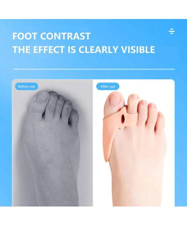 Xiongqi Silicone Toe Separators - 2 Pairs for Overlapping Toes & Bunions Relief | Toe Spacers & Smoothing Orthoses - Buy Online on GoSupps.com