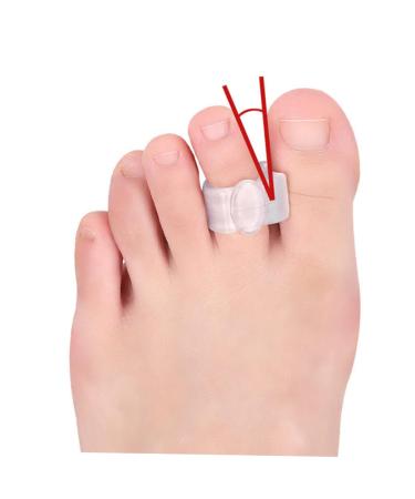 FRCOLOR 4 Pairs Gel Toe Separators for Men - Toe Spacers & Bunion Sleeves for Foot Comfort and Support - Buy Online on GoSupps.com