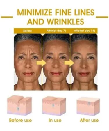  CRTZHA Fubsta SkinFirming Rejuvenating Oil Fubsta Skin Firming Oil Fubsta Skin Firming Oil Fubsta Skin Firming Serum Moisturizes Skin and Improves Fine Lines (2pcs) - Buy Online on GoSupps.com