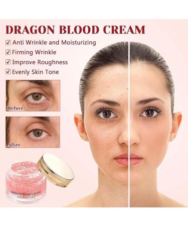 Baopinlady Dragon Blood Easy Cream Retinol Placenta Dragon Blood Cream 2024 New Anti Wrinkle Cream for Women Dragon's Blood Easy Cream Anti Wrinkle Serum for All Skin Types - Buy Online on GoSupps.com