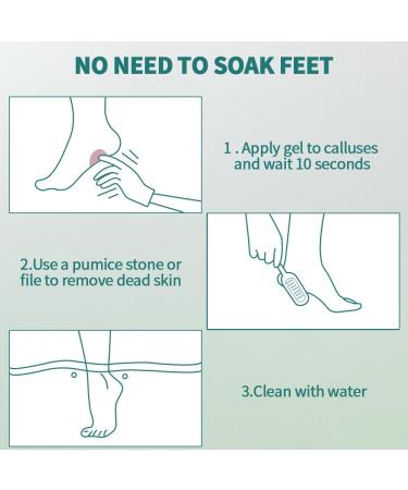 Buy Gorgellux Callus Remover Gel & Foot File Kit - Ultimate Spa Pedicure Set for Smooth Feet - Ships Internationally - Buy Online on GoSupps.com