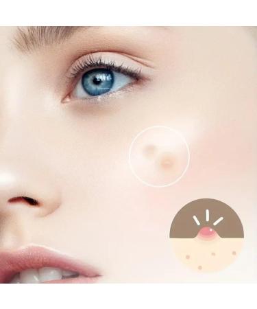 Acne Cover Patches with Salicylic Acid - 144pc Hydrocolloid Spot Treatment for Pimples & Whiteheads | Overnight Blemish Care - Buy Online on GoSupps.com