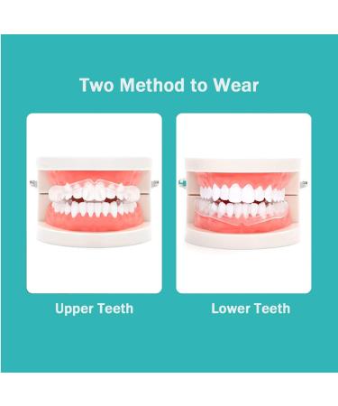 10 Pack Teeth Grinding Night Guards for Adults & Children - Anti-Teeth Grinding Mouth Guard Protection for Braces & Sleep - Buy Online on GoSupps.com