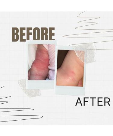 Generic Face Moisturizer for Women | Multi-Correcting Hydrating Cream for All Skin Types - 4 fl oz - Buy Online on GoSupps.com