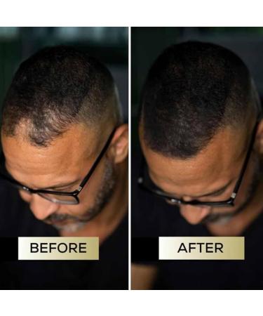Correcteur capillaire volumateur naturel invisible et naturel pour des cheveux plus s rs convient aux hommes et aux femmes. - Buy Online on GoSupps.com