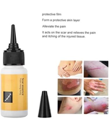 Scar Removal Cream - Acne Scar Treatment Serum for Smooth & Delicate Skin 20mL - Buy Online on GoSupps.com