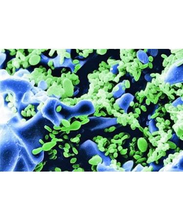 SERA SIBORAX Aquarium Filter Material 1000 ml - Organic Biological Filter Medium for Aquariums (Pack of 2) | Maximum Filtration Efficiency - Buy Online on GoSupps.com