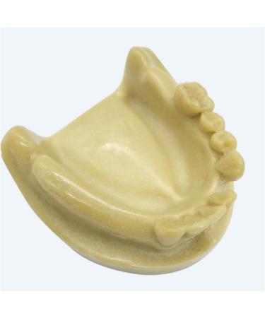 Fhuili Teeth Implant Model - Realistic Dental Simulation for Practice & Education | Lower Half Teeth Demonstration Model - Buy Online on GoSupps.com