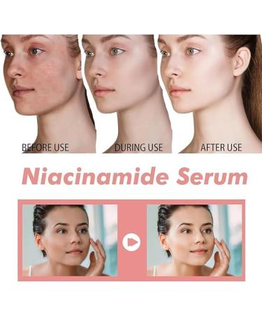 (Must - Have) 3 Jar Dark Spot Correcting Glow Serum ????% + ??% & Ceramide& Hyaluronic Acid& Vitamin - Buy Online on GoSupps.com