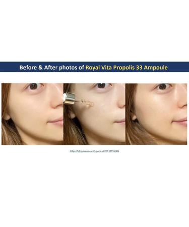Dr.Ceuracle Royal Vita Propolis 33 Ampoule & Cream - Nourishing Skin Serum & Moisturizer | 1.01 fl.oz. & 50g | International Shipping Available - Buy Online on GoSupps.com