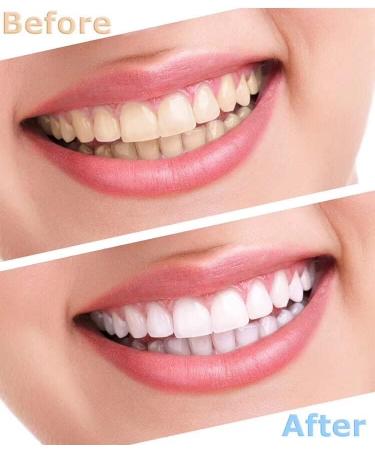 Teeth Whitening Gel - DOUCEUR Whitening Pen (2 Pcs) | Effective Painless No Sensitivity & Travel-Friendly - Buy Online on GoSupps.com
