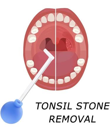 Tonsil Stone Remover Tool Manual Style Cleaner for Adults - 1pcs Yellow - Buy Online on GoSupps.com