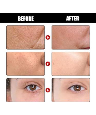 (My Favorites) KYOSK Advanced Deep Anti-Wrinkle Serum Anti Wrinkle Deep Wrinkle Serum Anti-Aging Collagen Dark Spot Corrector Advanced Deep Anti-Wrinkle Serum for All Skin Types 30ml/1.01fl.oz (3pcs) - Buy Online on GoSupps.com