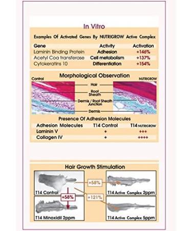 Nutrigrow Anti Hair Loss Conditioner for Faster Hair Growth - Buy Online on GoSupps.com