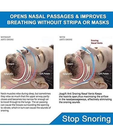 Comezy Anti Snoring Devices - 12 Nose Vents for Home and Travel - Snore Solution Nasal Dilators for Better Sleep - Buy Online on GoSupps.com