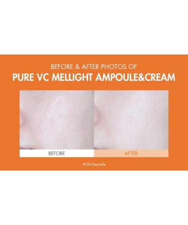 Dr.Ceuracle by leegeehaam Pure VC Mellight Ampoule - Vitamin C Serum for Face, One Week Program for Anti-oxidant, Firm, Clarify, Fade Pigmentation, Skin Radiance (1 Count (Pack of 1)) - Buy Online on GoSupps.com