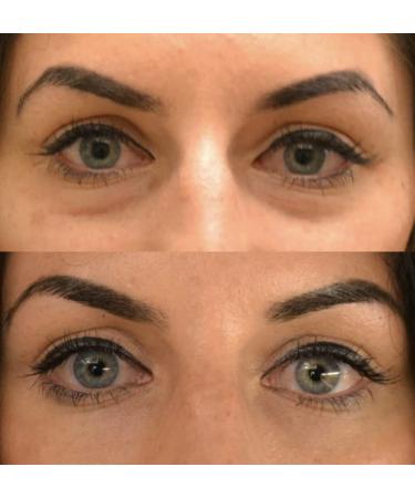 Bellmona Bio Signal Eye Cream - Brighten & Revitalize | International Shipping Available - Buy Online on GoSupps.com