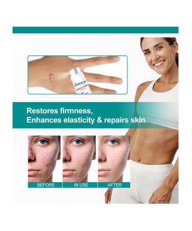 Advanced Scar Removal Spray for Surgical, Acne Scars & Stretch Marks - Skin Care (3pcs) - Buy Online on GoSupps.com