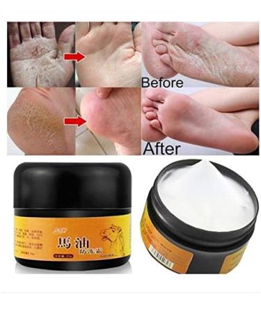 Bsttai Foot Cream - Ultimate Foot Care for Dry Itchy Skin | Hydrating Foot Balm & Mushroom Treatment - Buy Online on GoSupps.com