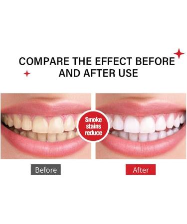 MS DRWIKEY Probiotics Bright White Toothpaste SP-6 Ultra Whitening Toothpaste MS DRWIKEY Toothpaste Sp-6 Brightening 120g Deep Cleaning Oral Care Toothpaste (3pcs) - Buy Online on GoSupps.com