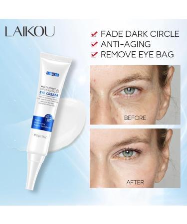 Eye Cream 30ml Visibly Reduces Under Eye Bags Wrinkles Dark Circles & Puffiness - Buy Online on GoSupps.com