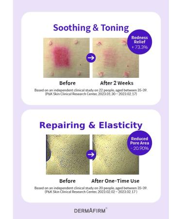  Refill DERMAFIRM Soothing Repair Toning Serum R4 - Korean Bakuchiol Retinol Niacinamide & Peptide Face Serum for Wrinkles - Calming Moisturizing & Correcting- Paraben-Free Cruelty-Free 1.01 fl oz - Buy Online on GoSupps.com