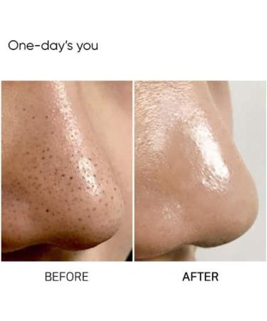 One-day's You P.Z. Ssoc Ssoc No More Blackhead 100ml - Buy Online on GoSupps.com